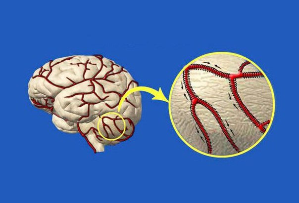 Как очистить сосуды головного мозга. Мощные рецепты народной медицины
