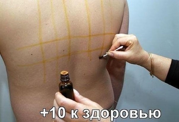 Целебные свойства йодовой сетки