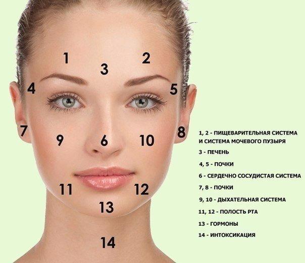 Прыщи - карта болезни на лице